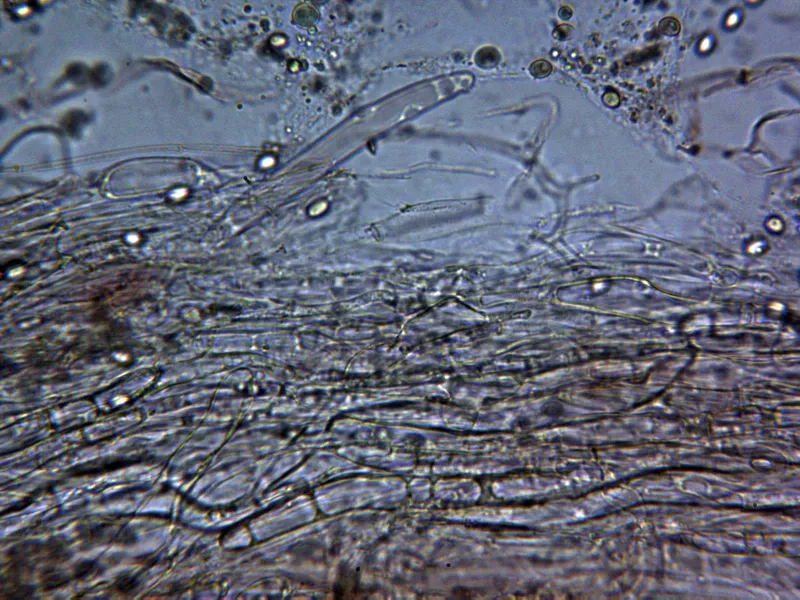 Armillaria bulbosa 10 - Suprapellis x 400 2